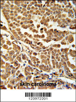 ZNF313 Antibody (C-term)