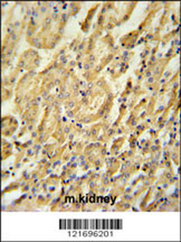 BTBD9 Antibody (Center)