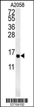 GOT1A Antibody (C-term)
