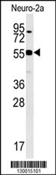 WDR18 Antibody (C-term)