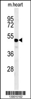 WDR18 Antibody (C-term)
