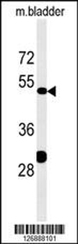 KLC3 Antibody (Center)