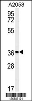 MFSD3 Antibody (Center)