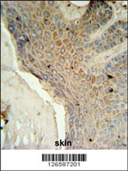 MFSD3 Antibody (Center)