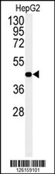 NR5A1 Antibody (N-term)