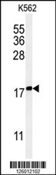KRTAP1-1 Antibody (Center)
