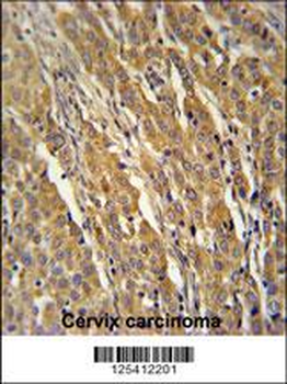 PDXD1 Antibody (C-term)