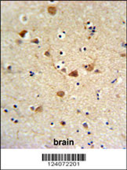FCGR1A Antibody (Center)