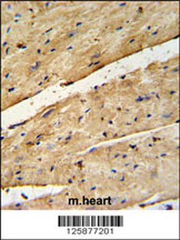 B3GNT7 Antibody (Center)