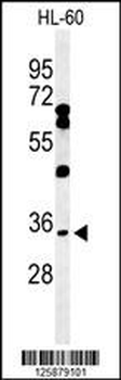 BHLHB5 Antibody (Center)