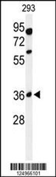 GL8D2 Antibody (N-term)
