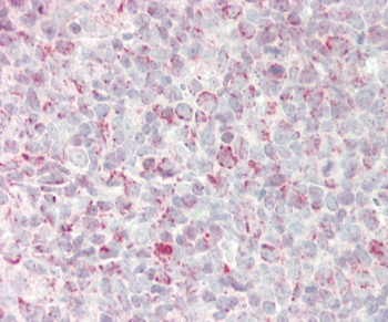 GADD45A Antibody (N-term)