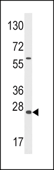 GADD45A Antibody (N-term)