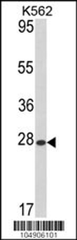ARL1 Antibody (N-term)