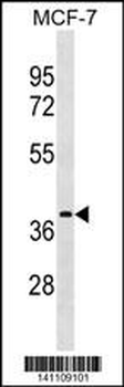 ESR1 isoform4 Antibody(Center)