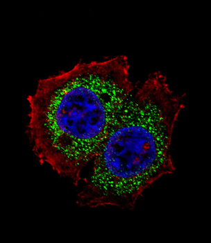 ESR1 isoform4 Antibody(Center)