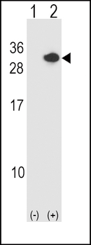 RCAN1 Antibody (N-term)