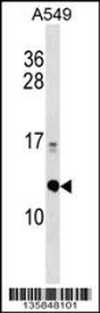 ERH Antibody (N-term)