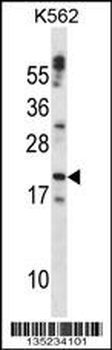 CTF1 Antibody (C-term)