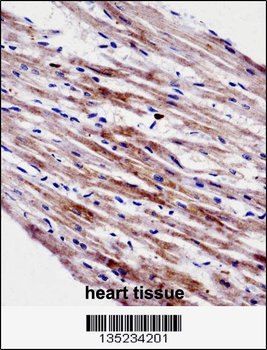 CTF1 Antibody (C-term)