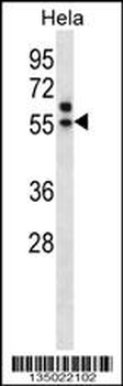 TADA3L Antibody (C-term)