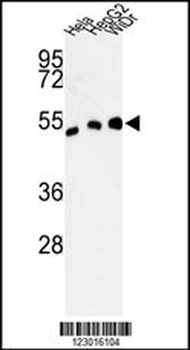ALDH3A2 Antibody