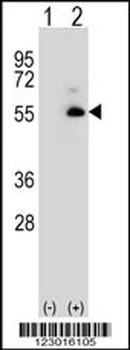 ALDH3A2 Antibody
