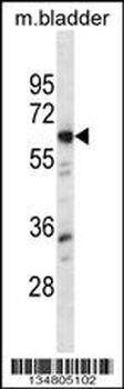 Mouse Lyn Antibody (N-term)