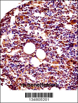 Mouse Lyn Antibody (N-term)