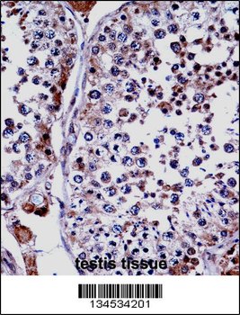 DUSP15 Antibody (Center)