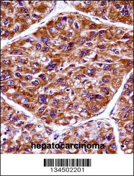EIF2AK3 Antibody (N-term)