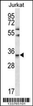 CELA3A Antibody (Center)