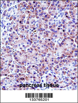CELA3A Antibody (Center)