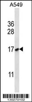 NFYB Antibody (N-term)