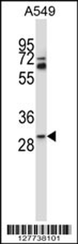 TATDN1 Antibody (Center)