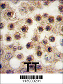YBX2 Antibody (C-term)