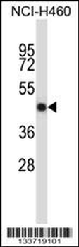 TNFRSF11B Antibody (Center)