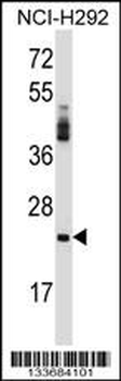 PRSS2 Antibody (Center)