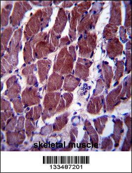 FIZ1 Antibody (C-term)