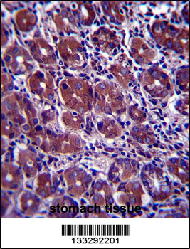 GOPC Antibody (C-term)