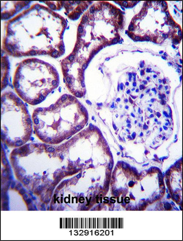 TXNDC15 Antibody (C-term)
