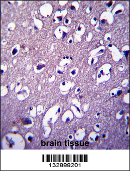 DCTN4 Antibody (N-term)