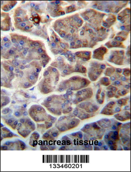 SNX29 Antibody (C-term)