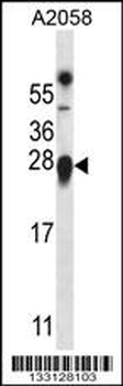 TMED9 Antibody (C-term)