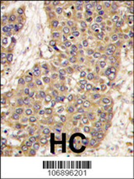 CASP6 Antibody (C-term)