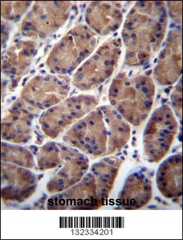 PFDN5 Antibody (Center)