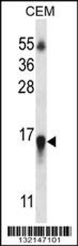 HIST1H2BN Antibody (N-term)