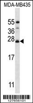 RM50 Antibody (C-term)