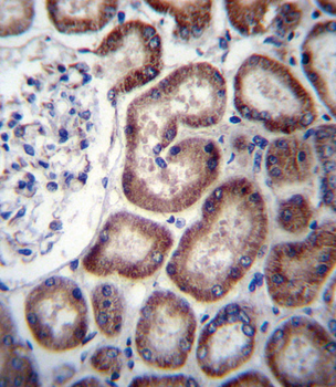 IREB2 Antibody (Center)