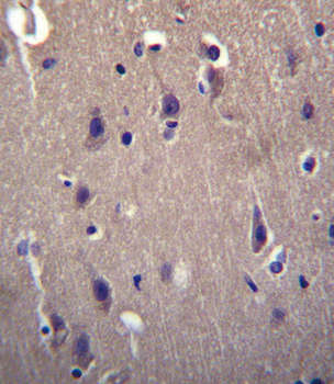 CARTPT Antibody (N-term)